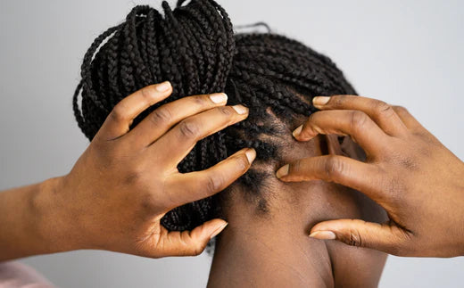5 ways to soothe an itchy scalp